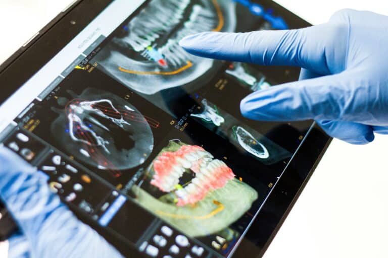 Personalizovaná stomatologie: Umělá inteligence a 3D tisk v Singapuru